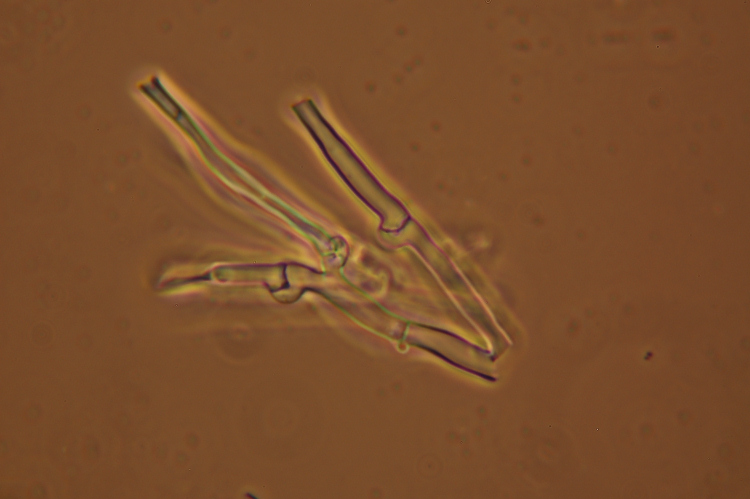 Crosta dubbia - foto 5524 (Hyphodontia gossypina?)